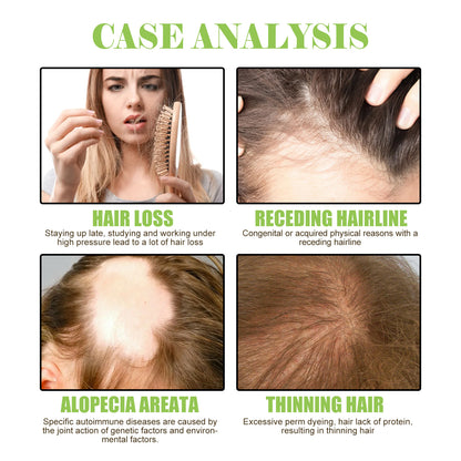 Ginger Care Shampoo Scalp Cleansing, Anti-Break Nourishing Root Strengthening Shampoo Health Eprolo https://www.cyberehub.com