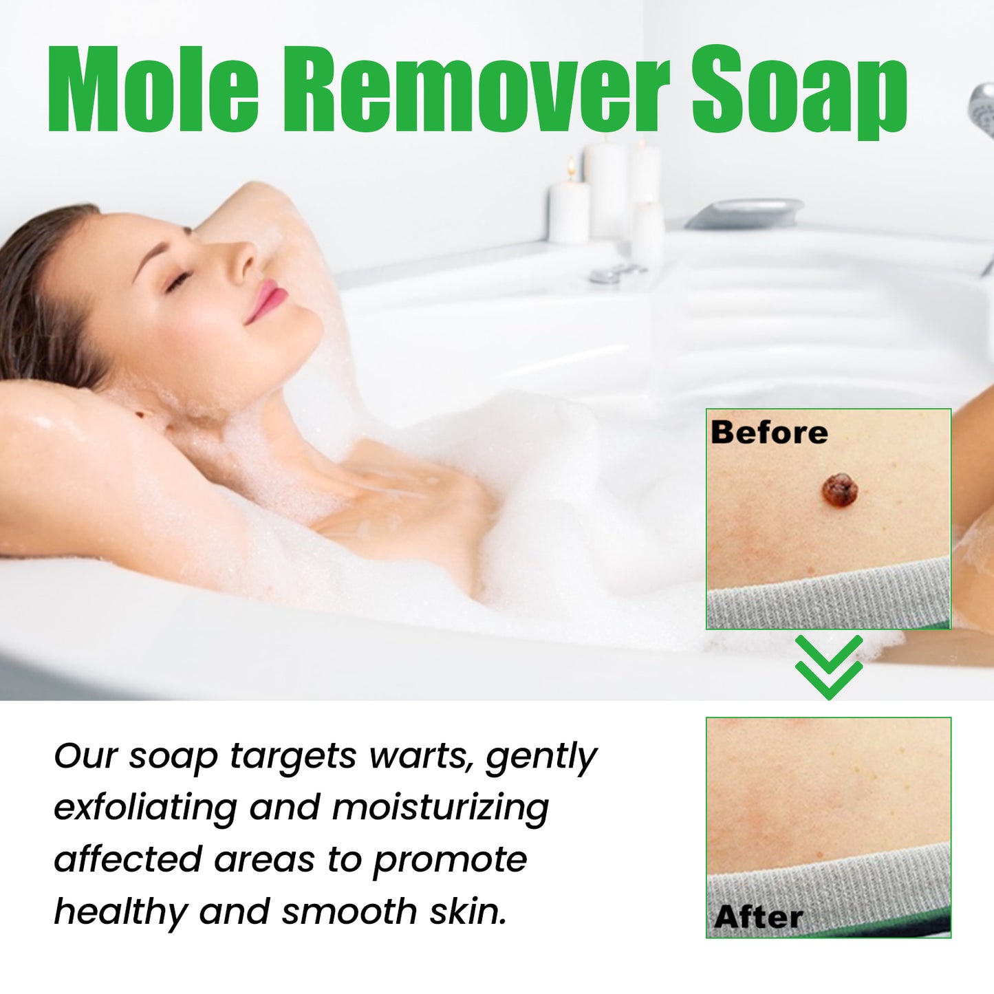 Mole Remover Soap, Repair Meat Granules Corns And Dark Moles, Smooth Skin Anti-wart Cleansing Soap Health Eprolo https://www.cyberehub.com