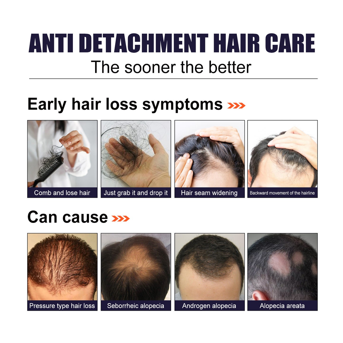 Herbal Hair Essence, Moisturizes Scalp Strong Hair Roots Thick Beard Care Essence Health Eprolo https://www.cyberehub.com
