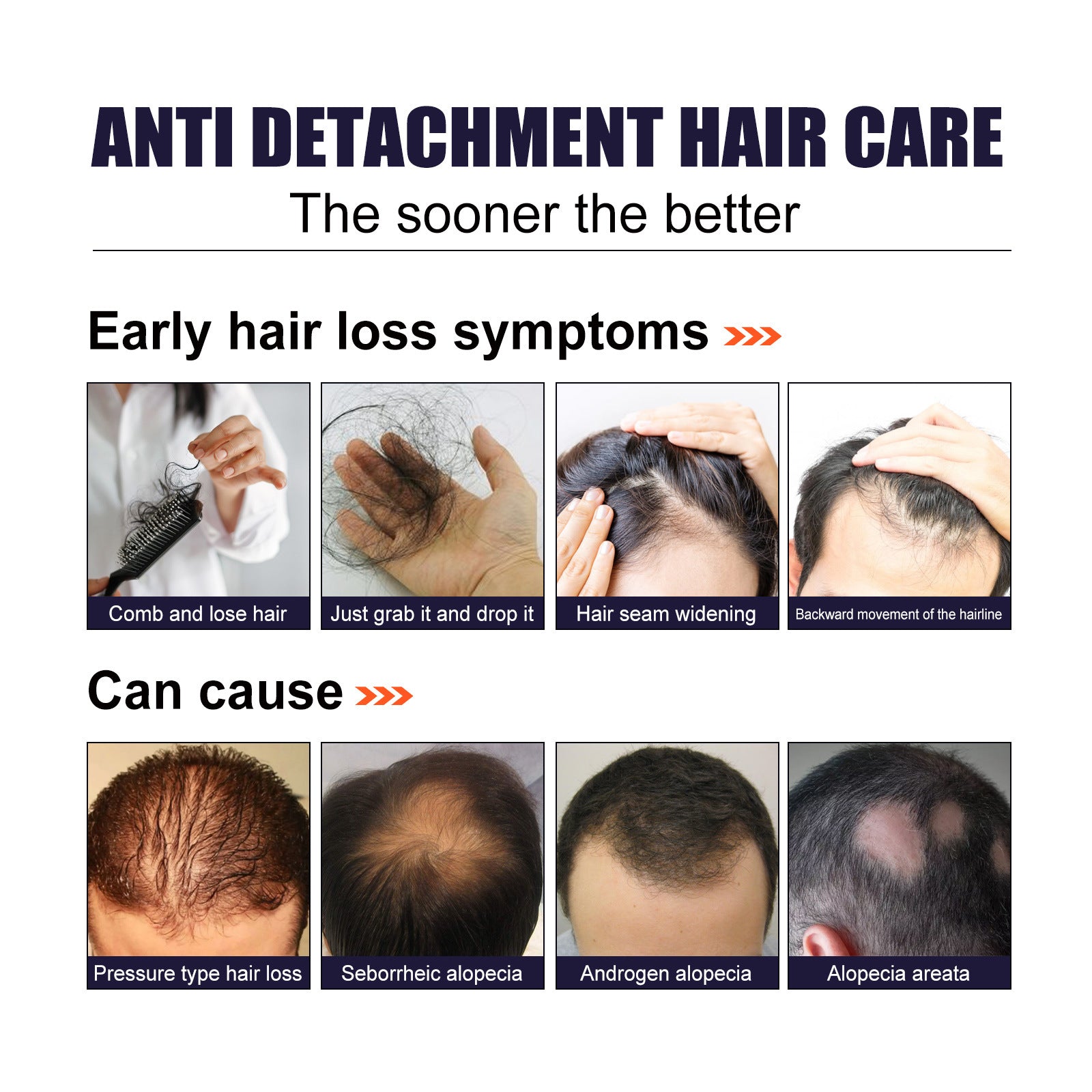 Herbal Hair Essence, Moisturizes Scalp Strong Hair Roots Thick Beard Care Essence Health Eprolo https://www.cyberehub.com