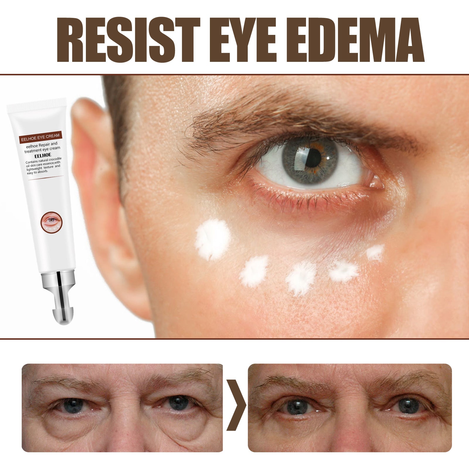Jojoba Oil Essential Eye Cream, Firming And Lifting Eye Bags To Reduce Dark Circles Repair Eye Cream Health Eprolo https://www.cyberehub.com