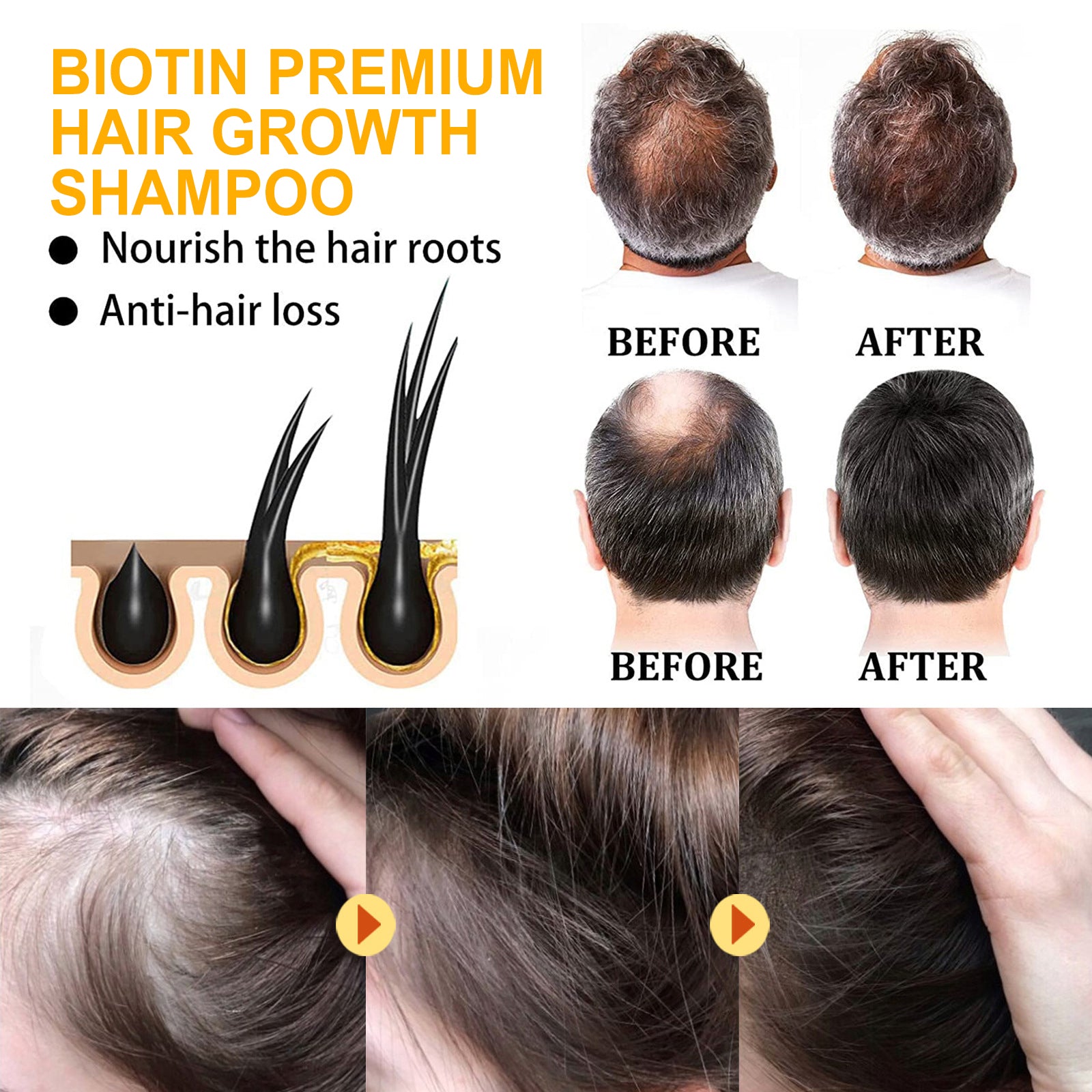 Biotin Shampoo Scalp Cleansing Gently Nourishes Hair Moisturizing Smooth And Glossy Shampoo Health & Beauty Health Eprolo https://www.cyberehub.com