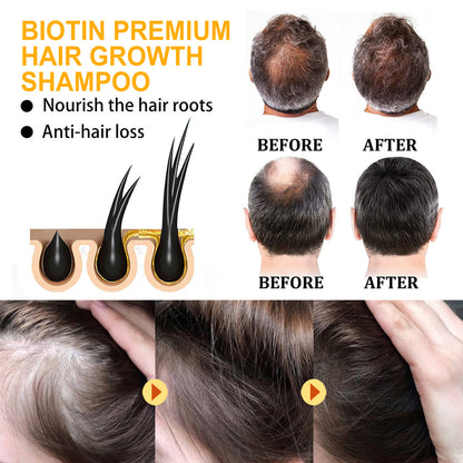 Biotin Shampoo Scalp Cleansing Gently Nourishes Hair Moisturizing Smooth And Glossy Shampoo Health & Beauty Health Eprolo https://www.cyberehub.com
