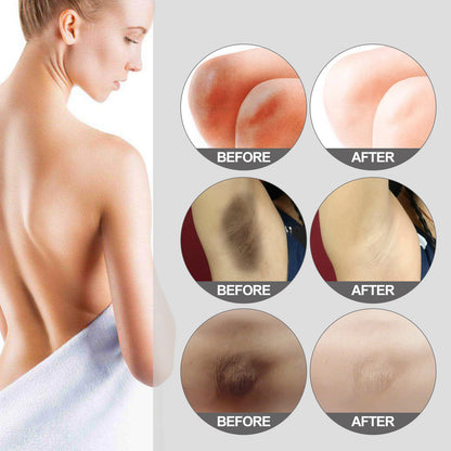 OUHOE Thigh Radiance Moisturizing And Brightening Cream For Armpit Thighs And Knees Health Eprolo https://www.cyberehub.com