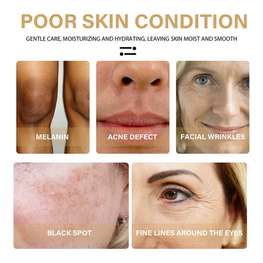 EELHOE Turmeric Dark Spot Correcting Serum Face Care Spot Moisturizing Nourishing Repairing Complexion Serum Health Beauty CJ USa USPS Muqe https://www.cyberehub.com