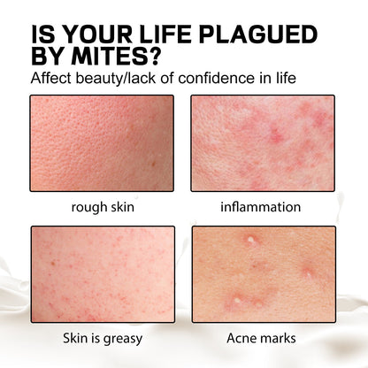 Deep Cleansing Facial Body Skin Lightening Acne Acne Print Multi-effect Cleansing Soap Health & Beauty Health & Beauty Under 10 UniversalMaax https://www.cyberehub.com