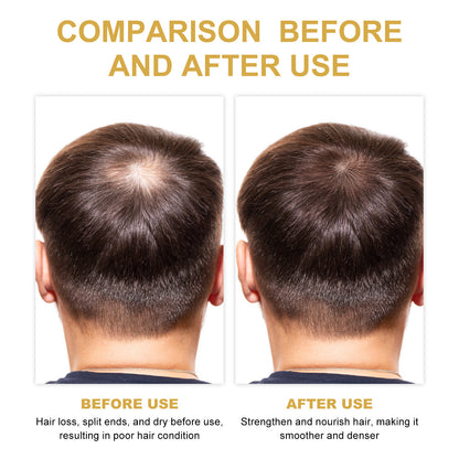 EELHOE Rosemary Hair Treatment Oil Scalp Cleansing Conditioning Volumizing Smoothing Repair Dry Frizzy Hair Conditioning Hair Treatment Oil Health Beauty CJ USa USPS Muqe https://www.cyberehub.com