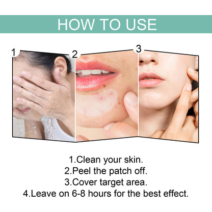 EELHOE Acne Relief Mask Patch Is A Gentle, Non-irritating Acne Mask That Helps To Reduce Acne Marks And Heal Acne. Health Beauty CJ USa USPS Muqe https://www.cyberehub.com
