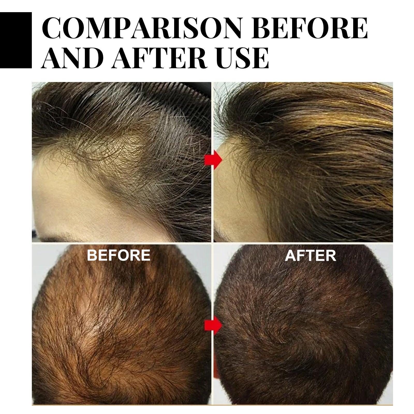 Nourishing And Moisturizing Hair Daily Shampoo Health & Beauty Health & Beauty Under 10 UniversalMaax https://www.cyberehub.com