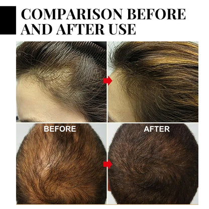 Nourishing And Moisturizing Hair Daily Shampoo Health & Beauty Health & Beauty Under 10 UniversalMaax https://www.cyberehub.com